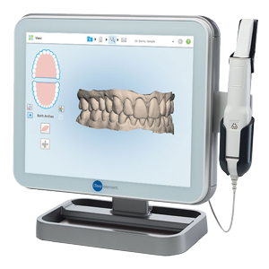 iTero digital scanning invisalign 2 - Your Treatment